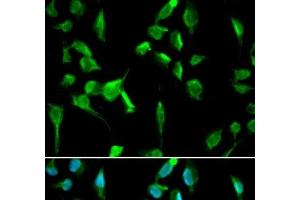 Immunofluorescence analysis of A549 cells using TOPBP1 Polyclonal Antibody (TOPBP1 anticorps)