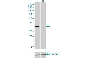 Western Blotting (WB) image for anti-Kv Channel Interacting Protein 2 (KCNIP2) (AA 1-100) antibody (ABIN466204) (KCNIP2 anticorps  (AA 1-100))