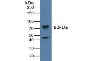 Detection of BARK in Human Raji Cells using Polyclonal Antibody to Beta Adrenergic Receptor Kinase (BARK) (beta-Adrenergic Receptor Kinase (AA 398-640) anticorps)