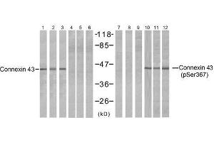 Western blot analysis of extracts from HeLa (Line 1, 4, 7 and 10), K562 (Line 2, 5, 8 and 11) and 293 (Line 3, 6, 9 and 12) cells, untreated or treated with PMA (1 η M 30min), using Connexin43 (Ab-367) antibody (E021250, Lane 1, 2, 3, 4, 5 and 6) and Connexin43 (phospho-Ser367) antibody (E011258, Lane 7, 8, 9, 10, 11 and 12). (Connexin 43/GJA1 anticorps  (pSer367))