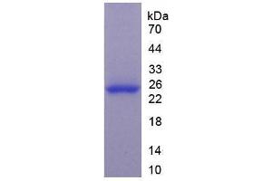 Image no. 1 for Glutathione S-Transferase pi 1 (GSTP1) (AA 1-210) (Active) protein (His tag) (ABIN6239834) (GSTP1 Protein (AA 1-210) (His tag))