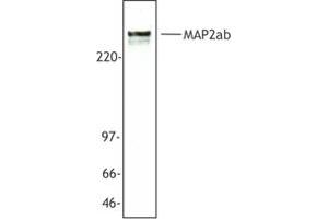 Image no. 1 for anti-Microtubule-Associated Protein 2 (MAP2) antibody (ABIN205408) (MAP2 anticorps)