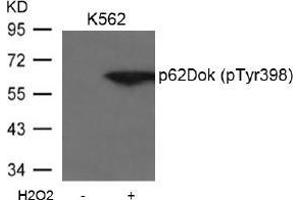 Image no. 2 for anti-Docking Protein 1, 62kDa (Downstream of tyrosine Kinase 1) (DOK1) (pTyr398) antibody (ABIN197043) (DOK1 anticorps  (pTyr398))