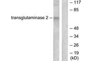 Western blot analysis of extracts from HuvEc cells, using Transglutaminase 2 Antibody. (Transglutaminase 2 anticorps  (AA 1-50))