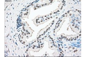 Immunohistochemical staining of paraffin-embedded lung tissue using anti-SSBmouse monoclonal antibody. (SSB anticorps)