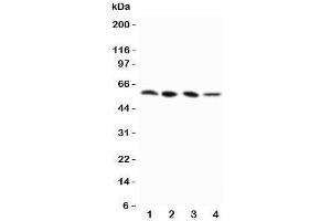 Western blot testing of RIP3 antibody and Lane 1:  PANC;  2: SW620;  3: SKOV-3;  4: M231 cell lysate (MPRIP anticorps  (N-Term))