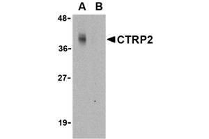 Image no. 1 for anti-C1q and Tumor Necrosis Factor Related Protein 2 (C1QTNF2) (N-Term) antibody (ABIN207816) (C1QTNF2 anticorps  (N-Term))