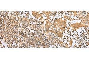 Immunohistochemistry of paraffin-embedded Human tonsil tissue using NDUFB3 Polyclonal Antibody at dilution of 1:25(x200) (NDUFB3 anticorps)