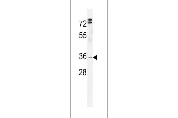 C3orf37 anticorps  (C-Term)