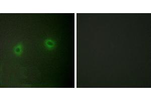 Peptide - +Immunofluorescence analysis of HeLa cells, using Caper antibody. (RBM39 anticorps  (Internal Region))