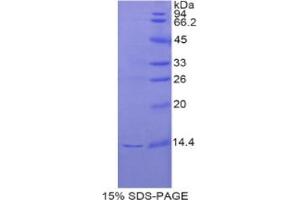 SDS-PAGE analysis of Rat REG3G Protein. (REG3g Protéine)