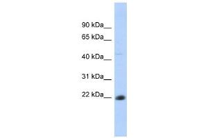 CD40 antibody used at 1 ug/ml to detect target protein. (CD40 anticorps  (N-Term))