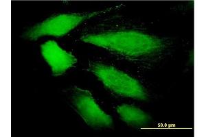 Immunofluorescence of monoclonal antibody to DDEF1 on HeLa cell. (ASAP1 anticorps  (AA 1030-1129))