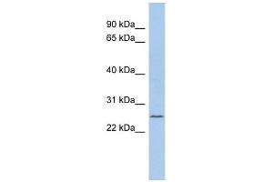 C11ORF53 antibody used at 1 ug/ml to detect target protein. (C11orf53 anticorps  (Middle Region))