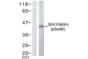 Western blot analysis of extract from 293 cells treated or untreated with UV, using SEK1/ MKK4 (phospho-Ser80) antibody (E011177). (MAP2K4 anticorps  (pSer80))