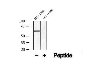 Western blot analysis of extracts of HT-1080 Jurkat cells, using KLF4 Antibody. (KLF4 anticorps)