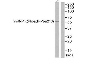 Western Blotting (WB) image for anti-Heterogeneous Nuclear Ribonucleoprotein K (HNRNPK) (pSer216) antibody (ABIN1847785) (HNRNPK anticorps  (pSer216))