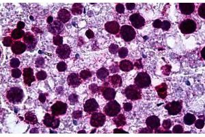 Human Testis: Formalin-Fixed, Paraffin-Embedded (FFPE) (FADS1 anticorps  (AA 1-100))