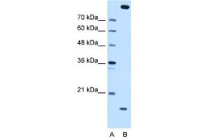WB Suggested Anti-CTAGE5 Antibody Titration:  0. (MIA2 anticorps  (Middle Region))
