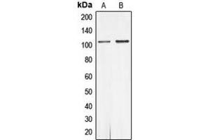 Western blot analysis of Androgen Receptor (pS650) expression in MCF7 (A), rat heart (B) whole cell lysates. (Androgen Receptor anticorps  (pSer650))