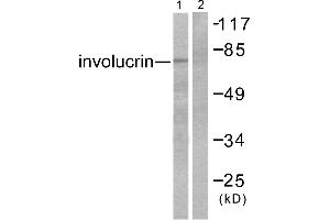 Western blot analysis of extracts from HuvEc cells, using Involucrin antibody (#C0236). (Involucrin anticorps)