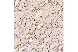 Immunohistochemistry of paraffin embedded human kidney using PAX2 (ABIN7074974) at dilution of 1:1000 (200x lens) (PAX2A anticorps)