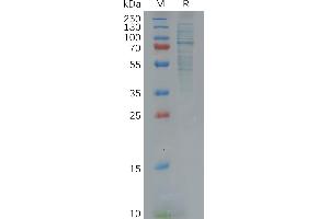 Human Protein, His Tag on SDS-PAGE under reducing condition. (GAS6 Protein (AA 31-678) (His tag))