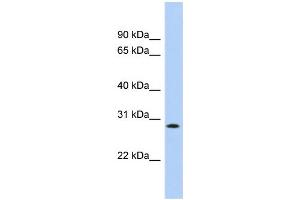 WB Suggested Anti-KCTD17 Antibody Titration:  0. (KCTD17 anticorps  (Middle Region))