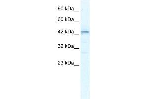 WB Suggested Anti-SP140L Antibody Titration:  2. (SP140L anticorps  (Middle Region))