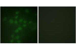 Immunofluorescence analysis of HuvEc cells, using Telomerase (Phospho-Ser227) Antibody. (TERT anticorps  (pSer227))
