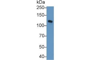 Detection of CDH5 in Rat Lung lysate using Polyclonal Antibody to Cadherin 5 (CDH5) (Cadherin 5 anticorps  (AA 59-382))