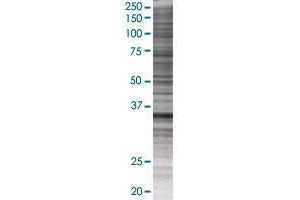 THAP10 transfected lysate. (THAP10 293T Cell Transient Overexpression Lysate(Denatured))