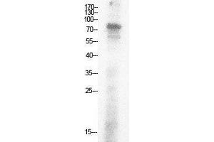 Western Blot (WB) analysis of HepG2 cells using Acetyl-Ub (K29) Polyclonal Antibody. (Ubiquitin anticorps  (acLys29))
