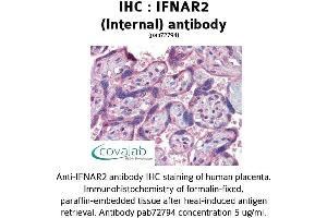 Image no. 1 for anti-Interferon alpha/beta Receptor 2 (IFNAR2) (Internal Region) antibody (ABIN1735773) (IFNAR2 anticorps  (Internal Region))