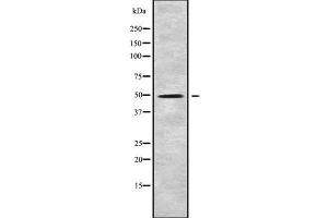 Western blot analysis of KCNJ8 using Jurkat whole cell lysates (KCNJ8 anticorps)