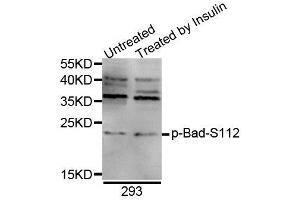 Western blot analysis of extracts of 293 cell line, using Phospho-Bad-S112 antibody (ABIN5969873). (BAD anticorps  (pSer75))