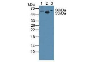 Western blot analysis of (1) Human PC-3 Cells, (2) Porcine Intestine Tissue and (3) Rat Prostate Gland Tissue. (ANTXR2 anticorps  (AA 34-318))