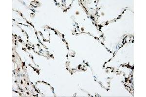 Immunohistochemical staining of paraffin-embedded prostate tissue using anti-DAPK2 mouse monoclonal antibody. (DAPK2 anticorps)