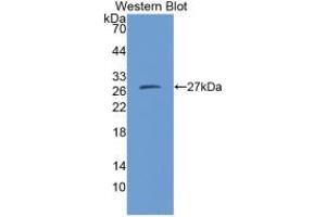 Western blot analysis of the recombinant protein. (CMA1 anticorps  (AA 22-247))