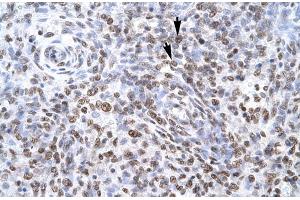 Human Spleen (ZNF500 anticorps  (Middle Region))