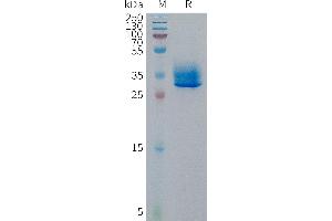 Human Protein, hFc Tag on SDS-PAGE under reducing condition. (GPR81 Protein (AA 1-21) (Fc Tag))