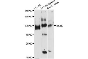 Western blot analysis of extracts of various cell lines, using ITGB2 antibody (ABIN5971200) at 1/1000 dilution. (Integrin beta 2 anticorps)