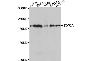 Western blot analysis of extracts of various cell lines, using TOP2A antibody (ABIN5970277) at 1/1000 dilution. (Topoisomerase II alpha anticorps)