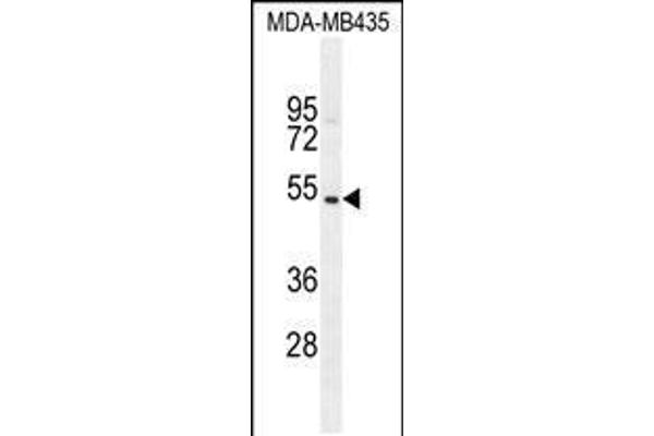 GFRAL anticorps  (C-Term)