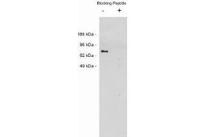 Image no. 1 for anti-Netrin 1 (NTN1) antibody (ABIN265183) (Netrin 1 anticorps)