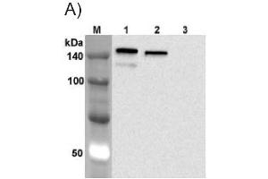 Western blot analysis using anti-Jagged-1 (human), mAb (J1G53-3)  at 1:1'000 dilution. (JAG1 anticorps)