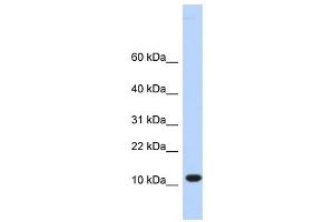 C10ORF57 antibody used at 1 ug/ml to detect target protein. (CJ057 anticorps  (Middle Region))