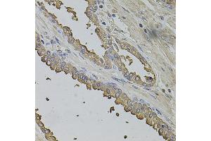 Immunohistochemistry of paraffin-embedded human prostate using FMR1NB antibody (ABIN5972990) at dilution of 1/100 (40x lens). (FMR1NB anticorps)