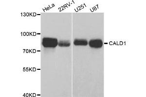 Western Blotting (WB) image for anti-Caldesmon 1 (CALD1) antibody (ABIN1876554) (Caldesmon anticorps)