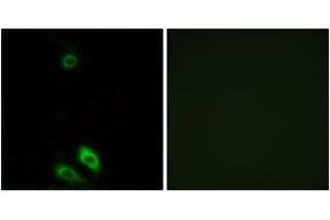 Immunofluorescence analysis of A549 cells, using AKR1CL1 Antibody. (AKR1CL1 anticorps  (AA 80-129))